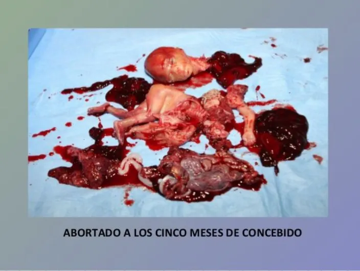 La nueva moda contemporánea pasa por aceptar con naturalidad la cultura de la muerte