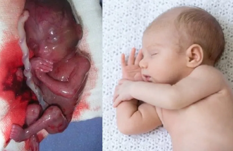 La semana en imágenes. España, paraíso del aborto: 94.000 asesinados y otras 94.000 zombis morales (las madres)