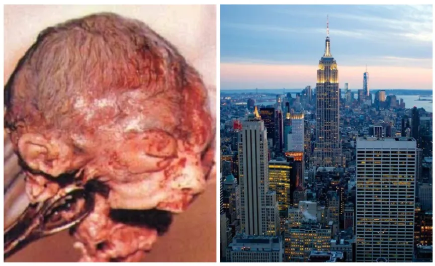Nueva York da asco: el aborto será legal durante todo el embarazo