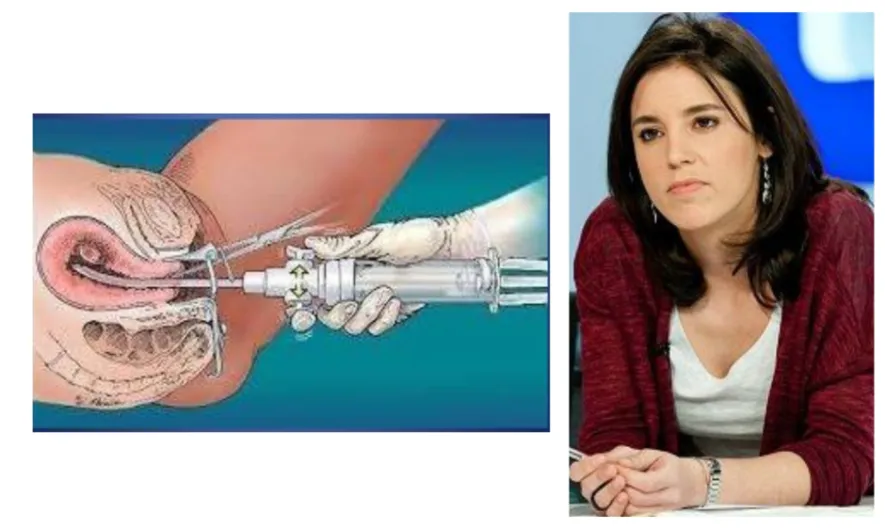 Irene Montero pretende obligar a los médicos a ejecutar abortos