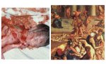 Comparado con la magnitud abortera actual, Herodes era un pringao: sólo asesinó a unos 100 menores