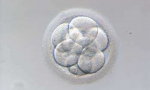 El embrión es un individuo con un ADN humano, con la misma dignidad humana que un anciano.