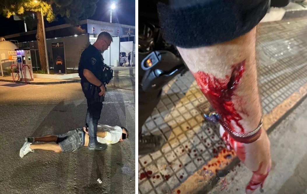 Agresión a un policía local en un control de alcoholemia por parte de un colombiano tras dar positivo