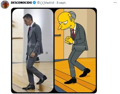 burns