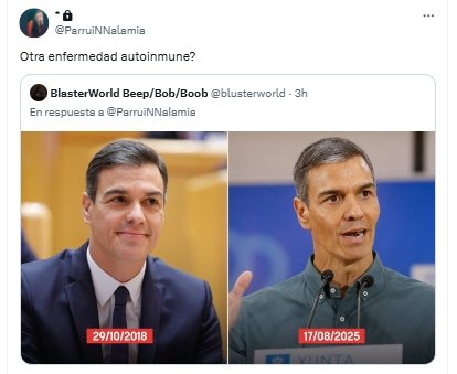 autoinmune copia autoinmune copia