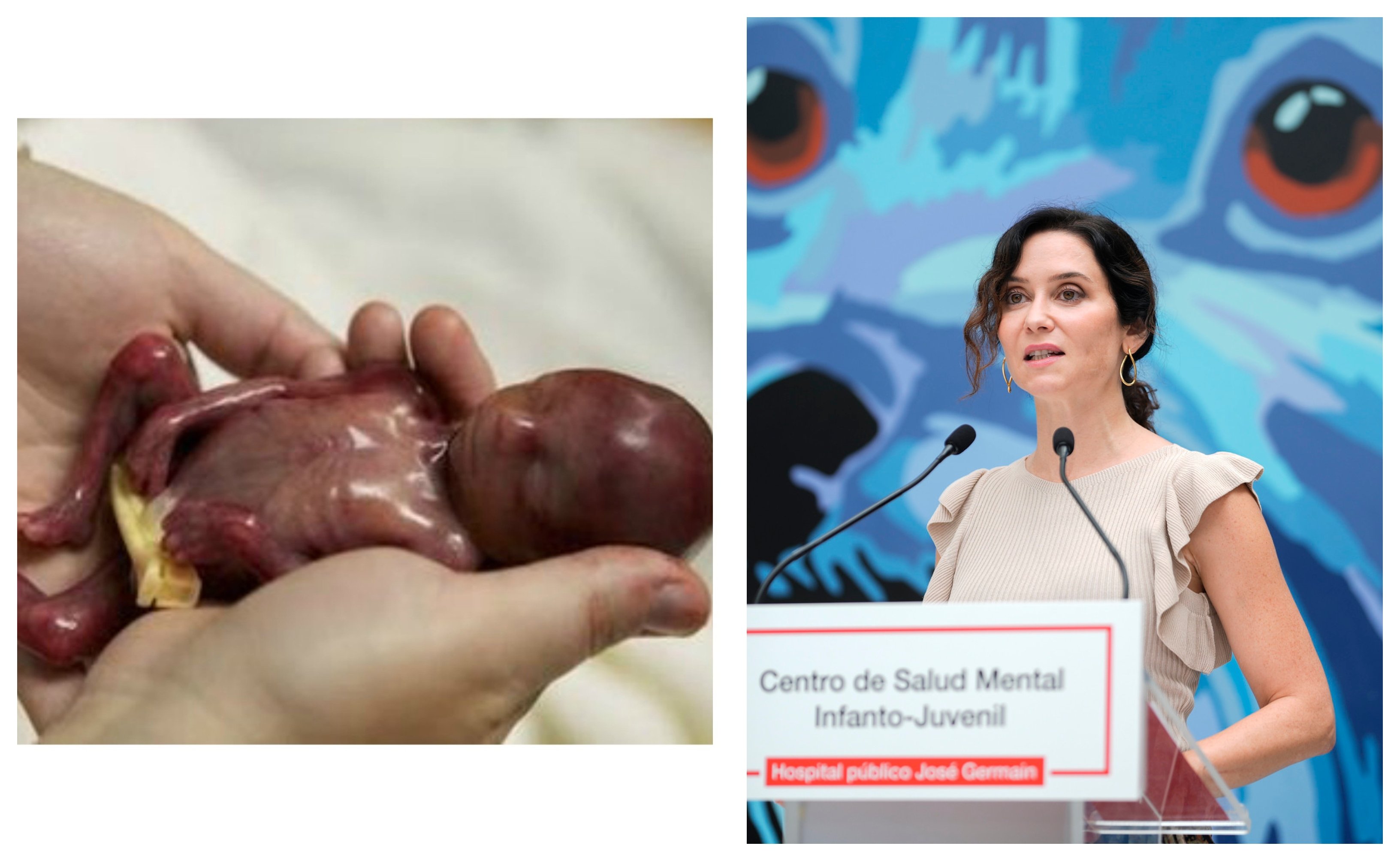 Isabel Díaz Ayuso, abortista. El resto es secundario Isabel Díaz Ayuso, abortista. El resto es secundario