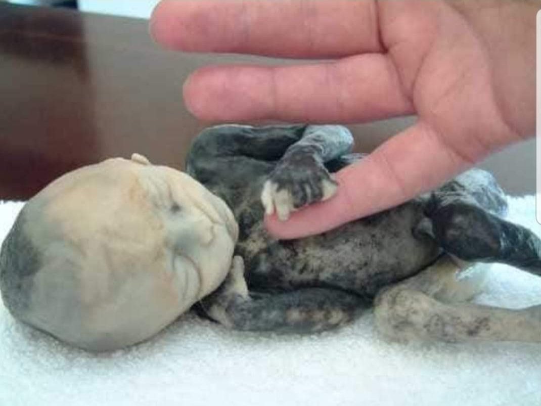 Un aborto por solución salina