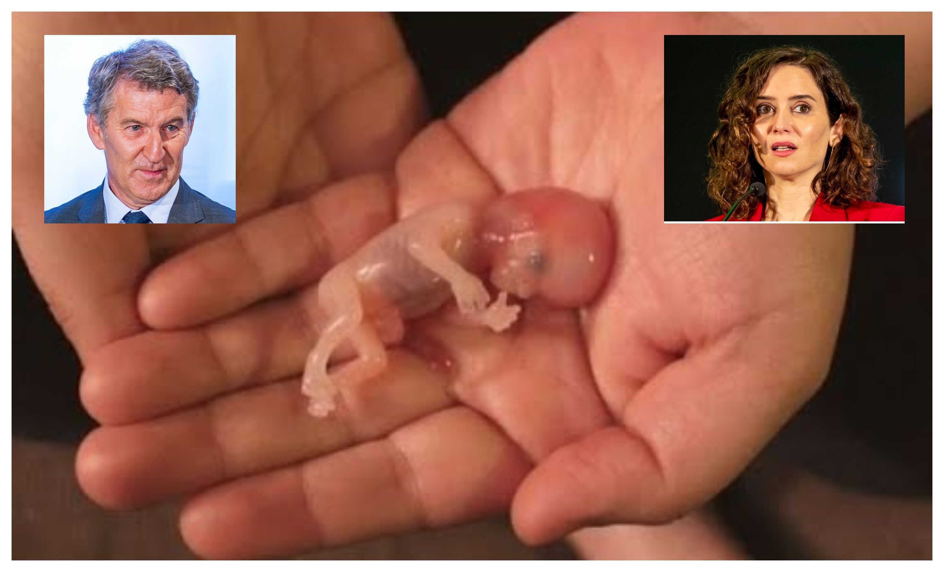 Feijoó es abortero, Ayuso es abortero... votar PP es votar aborto