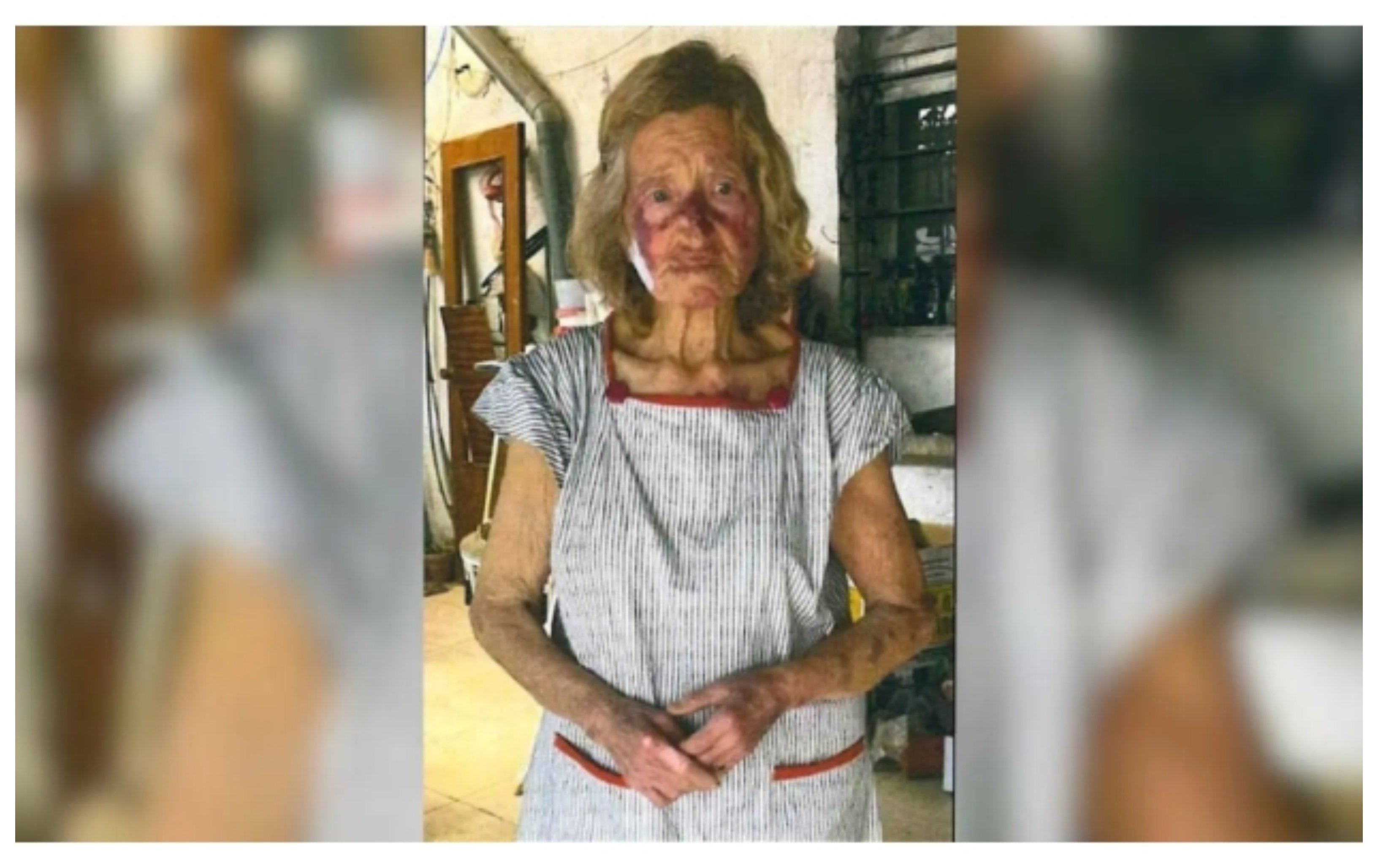 "Pensé que me mataban": Pilar, 88 años, secuestrada por tres hombres que la torturaron, clavándole unas tijeras en la cara... para llevarse 1.200 euros