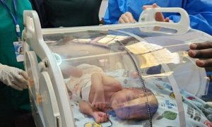 La ONG Medical Open World quiere evitar la muerte de bebés prematuros en países con escasos recursos