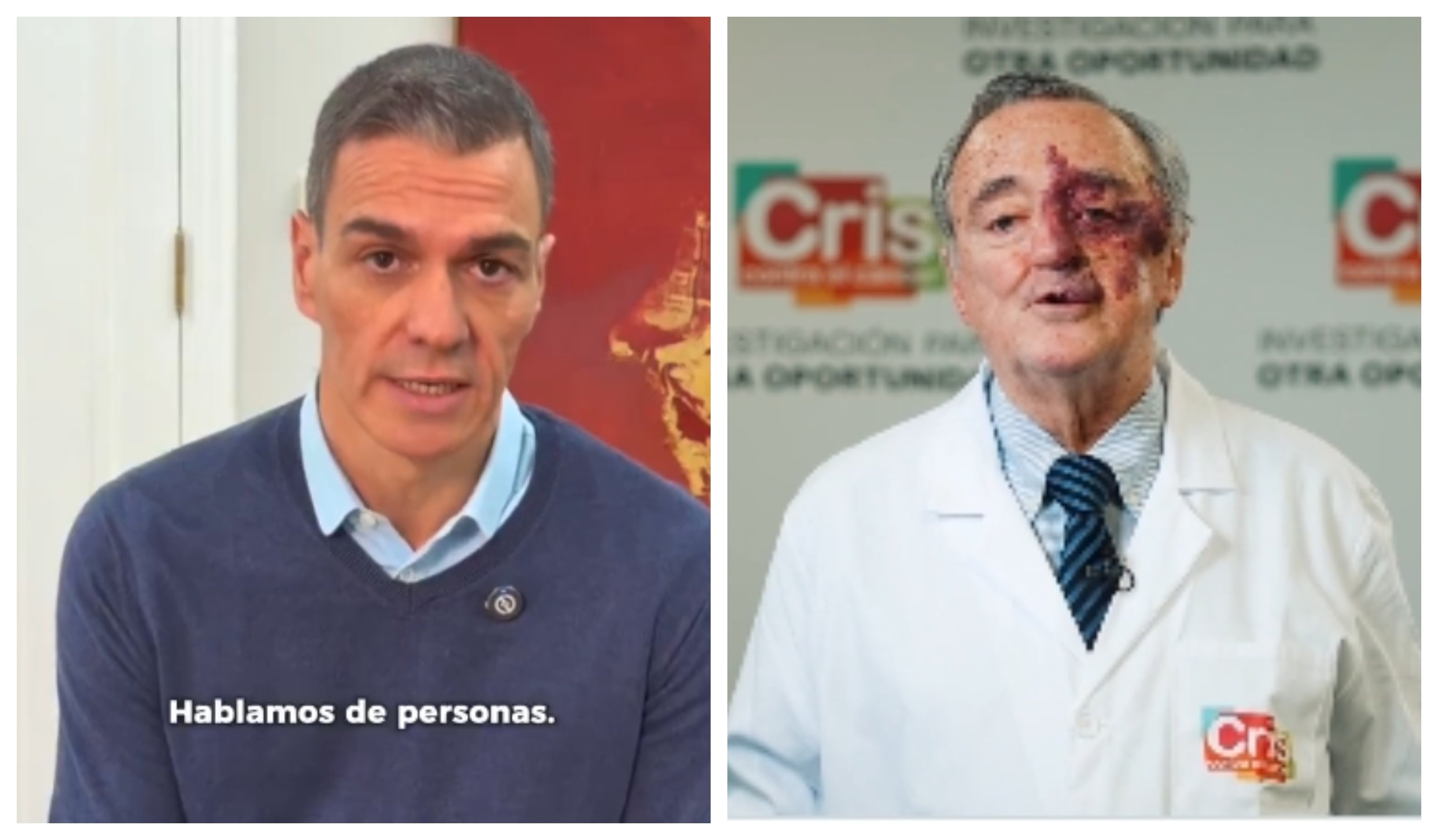 Hipocresía Sánchez: "La lucha contra el cáncer es un desafío de país: prevención, cribado, innovación, atención integral y calidad de vida"... ¿También en el de páncreas?