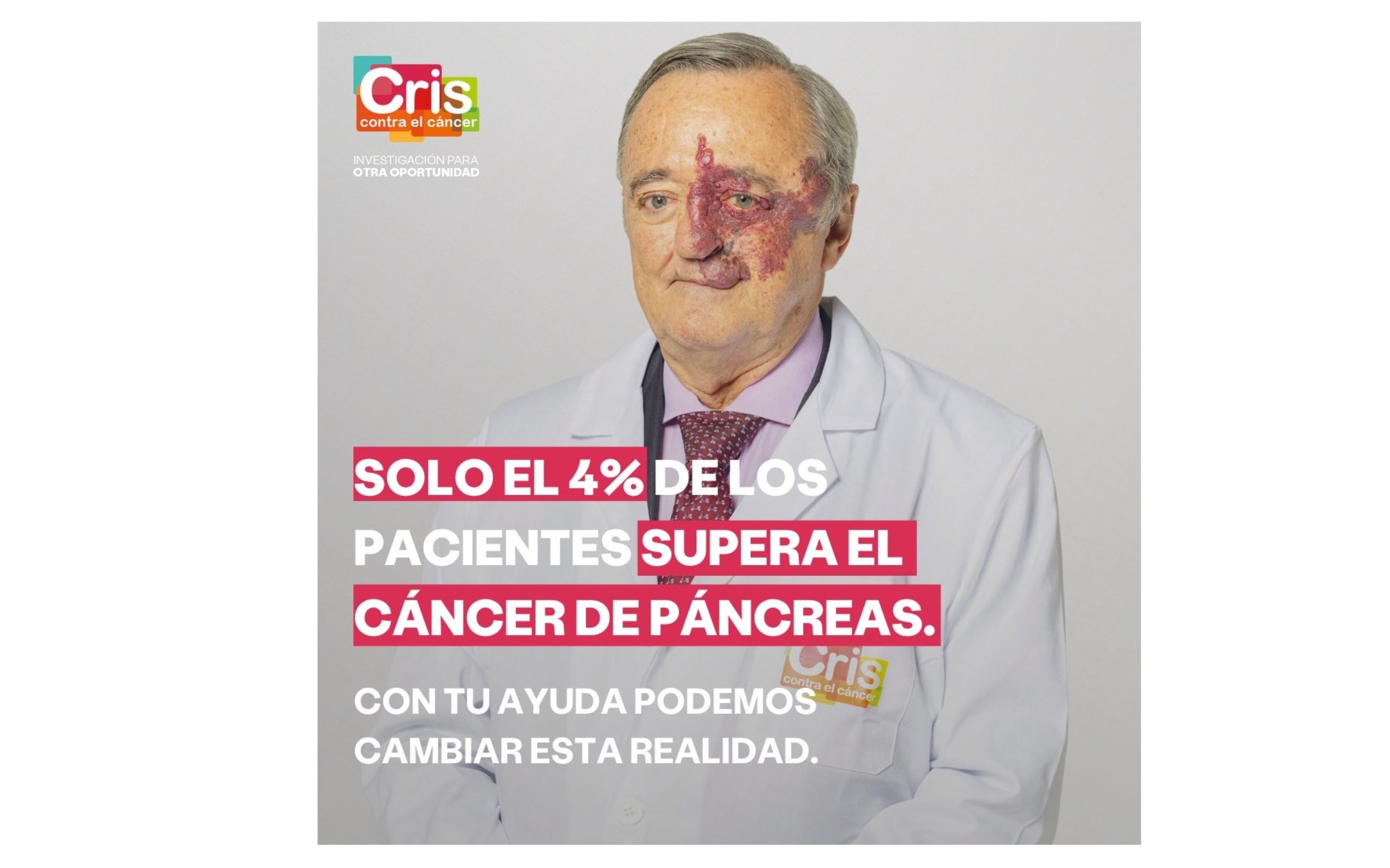 La mezquindad de El País: insinúa que Barbacid "proclama" que han logrado "la primera terapia efectiva contra el cáncer de páncreas", como si se refiriera a la eliminación en humanos