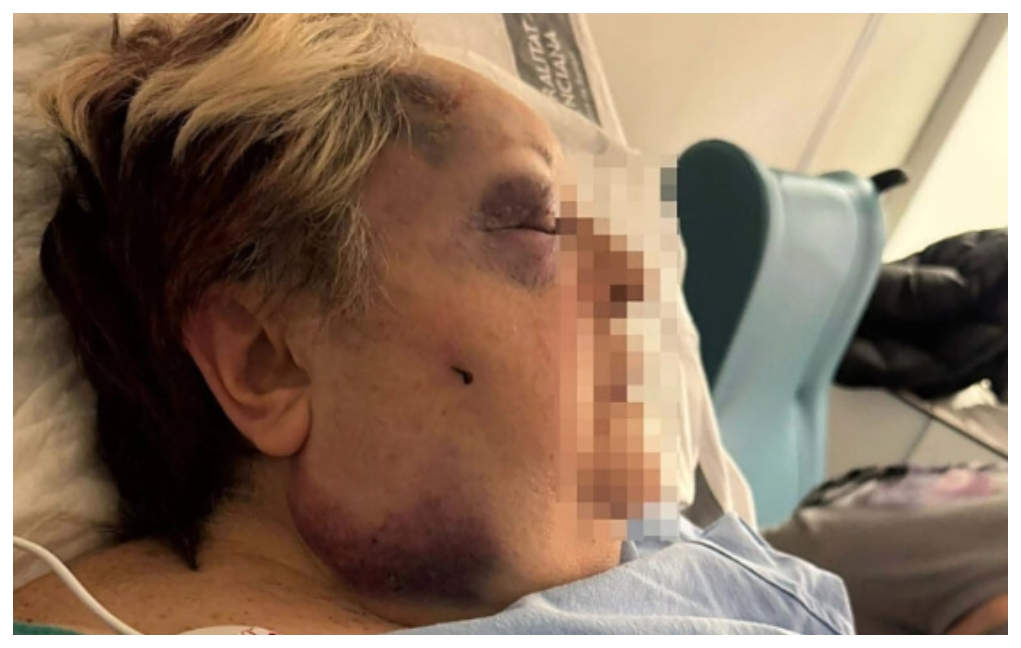 Dos inmigrantes magrebíes trataron de asaltar a Josefina, de 71 años, y, al comprobar que no tenía objetos de valor, le propinaron una brutal paliza