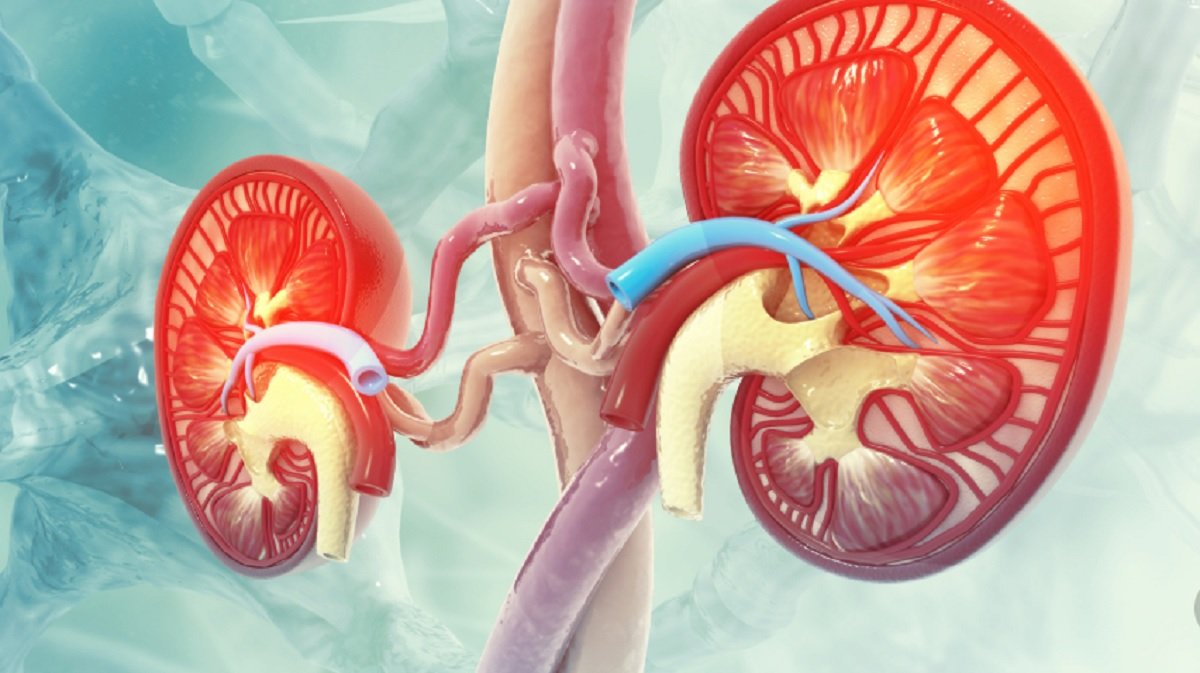 El cáncer de riñón es un tumor que se origina en las células del propio riñón El cáncer de riñón es un tumor que se origina en las células del propio riñón