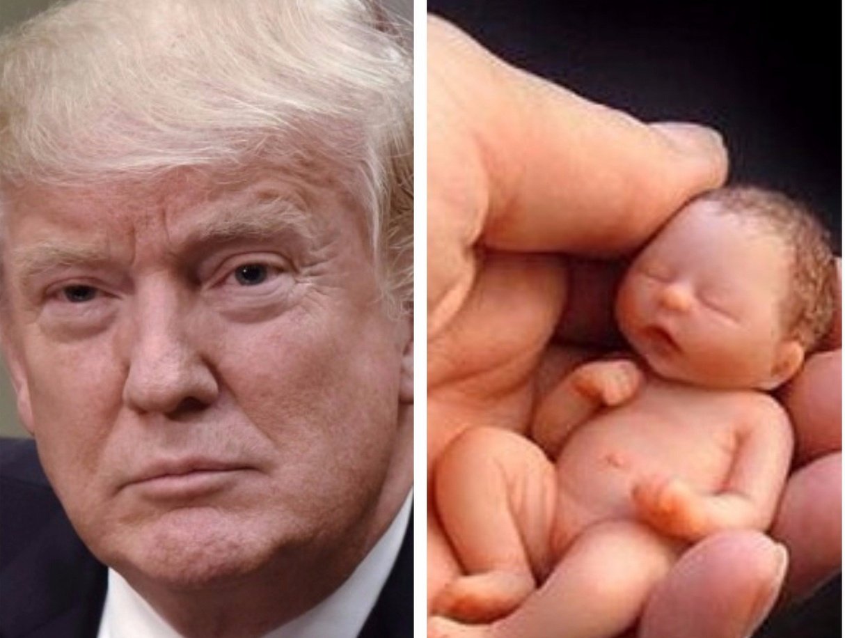 Trump protege la objeción de conciencia al aborto