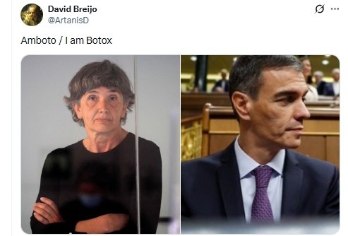 Botox Botox