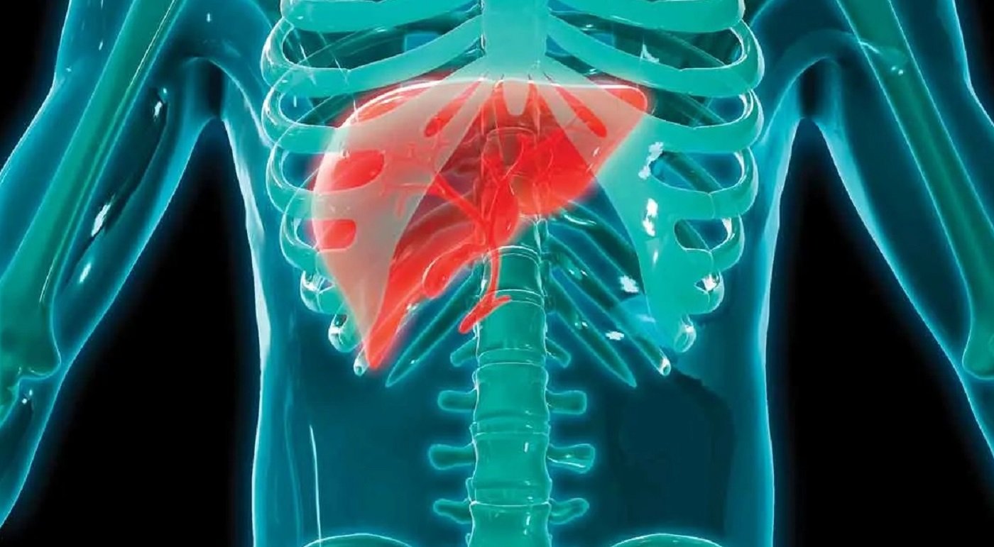 El hígado graso se está convirtiendo en una de las enfermedades hepáticas más comunes en Occidente,
