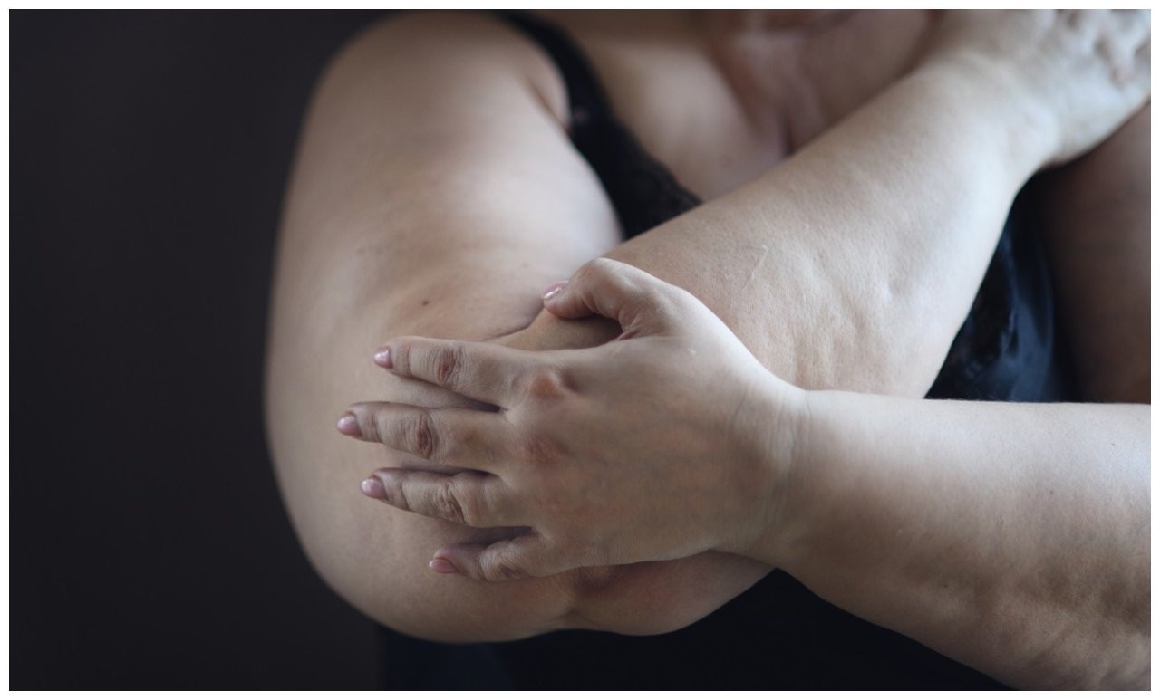 La obesidad sí impacta sobre tus huesos
