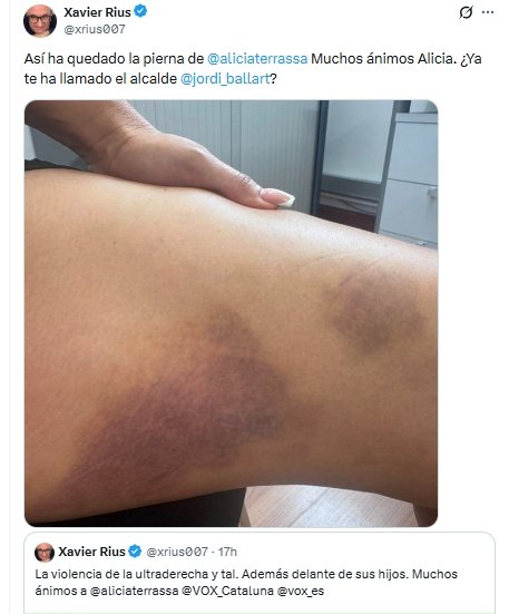 heridas
