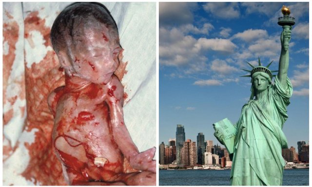 Esto es un aborto, que el Estado de Nueva York respalda sin restricciones