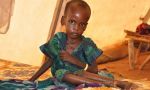 3,1 millones de niños menores de cinco años mueren cada año en África por desnutrición