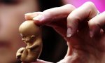 La Administración Trump prohibirá la investigación médica con tejidos de niños abortados