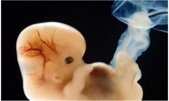 Embriones: 'Seréis como dioses'
