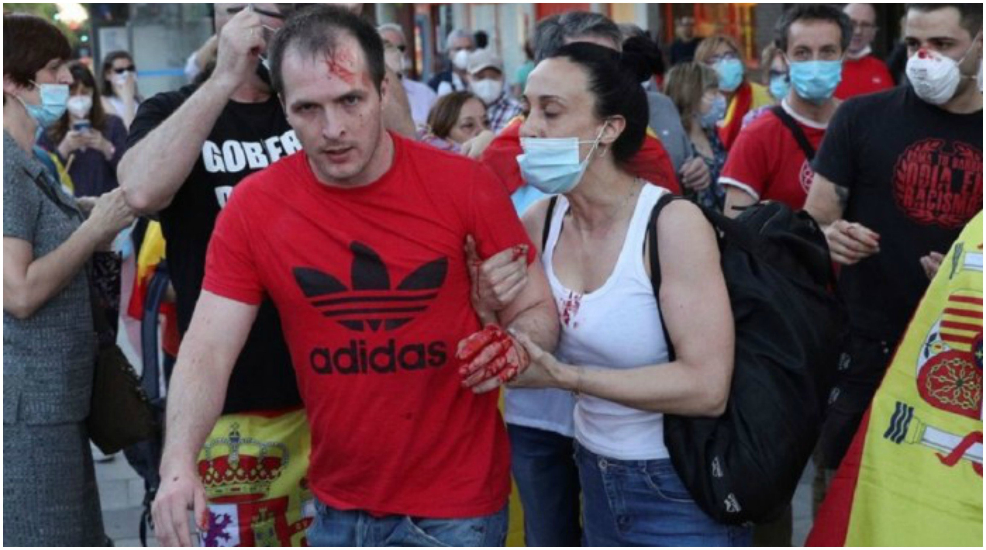 Alberto, el joven agredido en Moratalaz, junto a su novia Alberto, el joven agredido en Moratalaz, junto a su novia