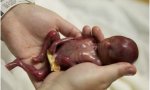 Bebé abortado a las 19 semanas