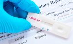 En cuestión de Coronavirus no todas las pruebas sirven para todo