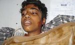 Pakistán: muere mártir el adolescente al que prendieron fuego por decir "soy cristiano"