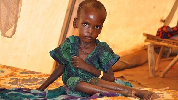 3,1 millones de niños menores de cinco años mueren cada año en África por desnutrición 3,1 millones de niños menores de cinco años mueren cada año en África por desnutrición