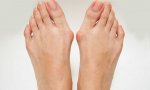No se sabe si el calzado apretado, de tacón alto o estrecho, puede causar el juanete en el pie o contribuir a su aparición