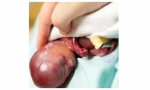 Texas promulgó la ley de los 'latidos del corazón': no abortar cuando estos se oyen