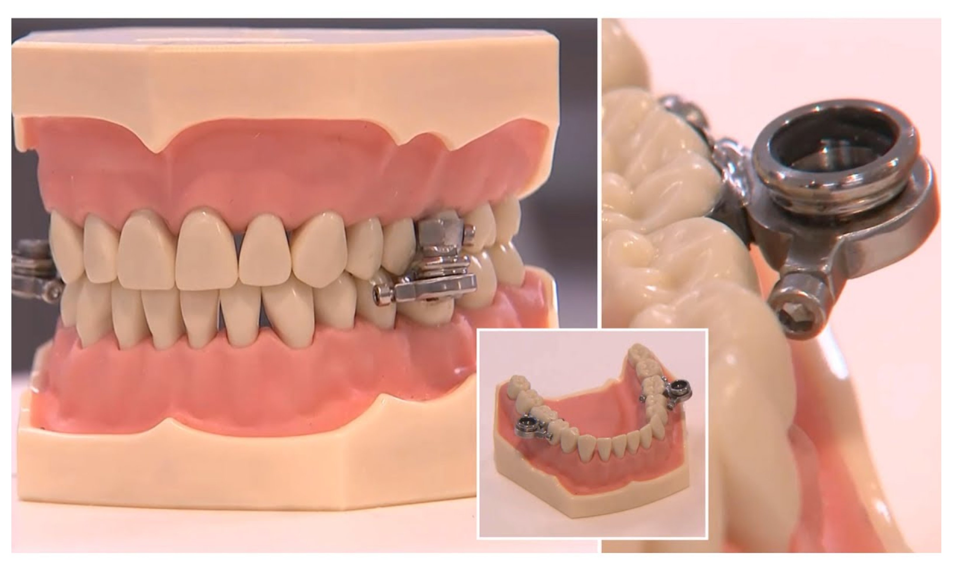 La necedad crece. Revolución en la dietética: si cierras la boca, no engordas