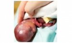 Texas promulgó la ley de los 'latidos del corazón': no abortar cuando estos se oyen.