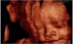 Francia profundiza en la cultura de la muerte: la Asamblea Nacional planea ampliar el plazo legal para abortar de 12 a 14 semanas