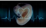 Texas promulgó la ley de los 'latidos del corazón': no abortar cuando estos se oyen. Idaho sigue los pasos...