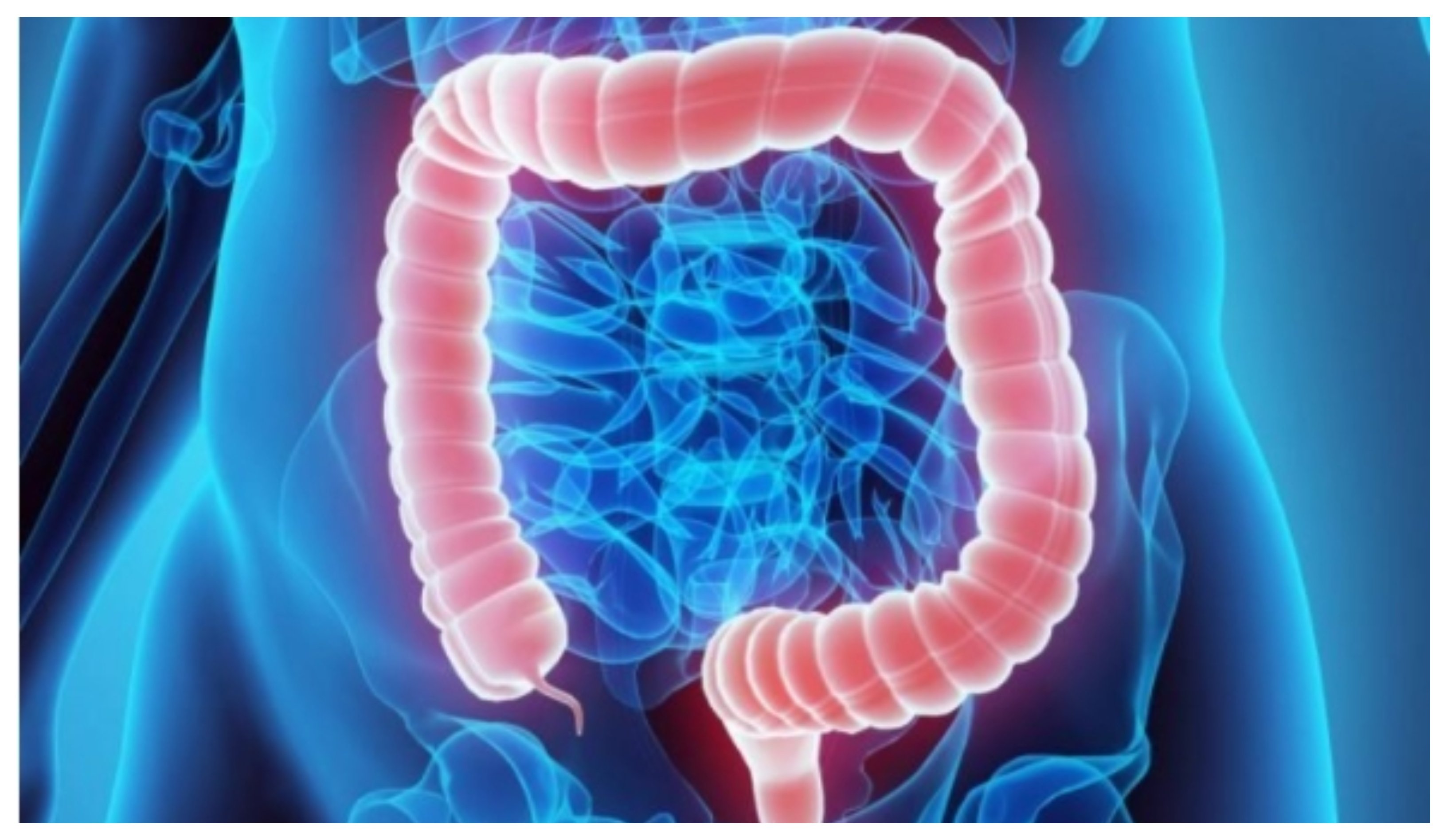 Повреждение толстой кишки. Повреждение толстой кишки. Повреждение толстой кишки. Повреждение толстой кишки. Колопроктология заболевания.