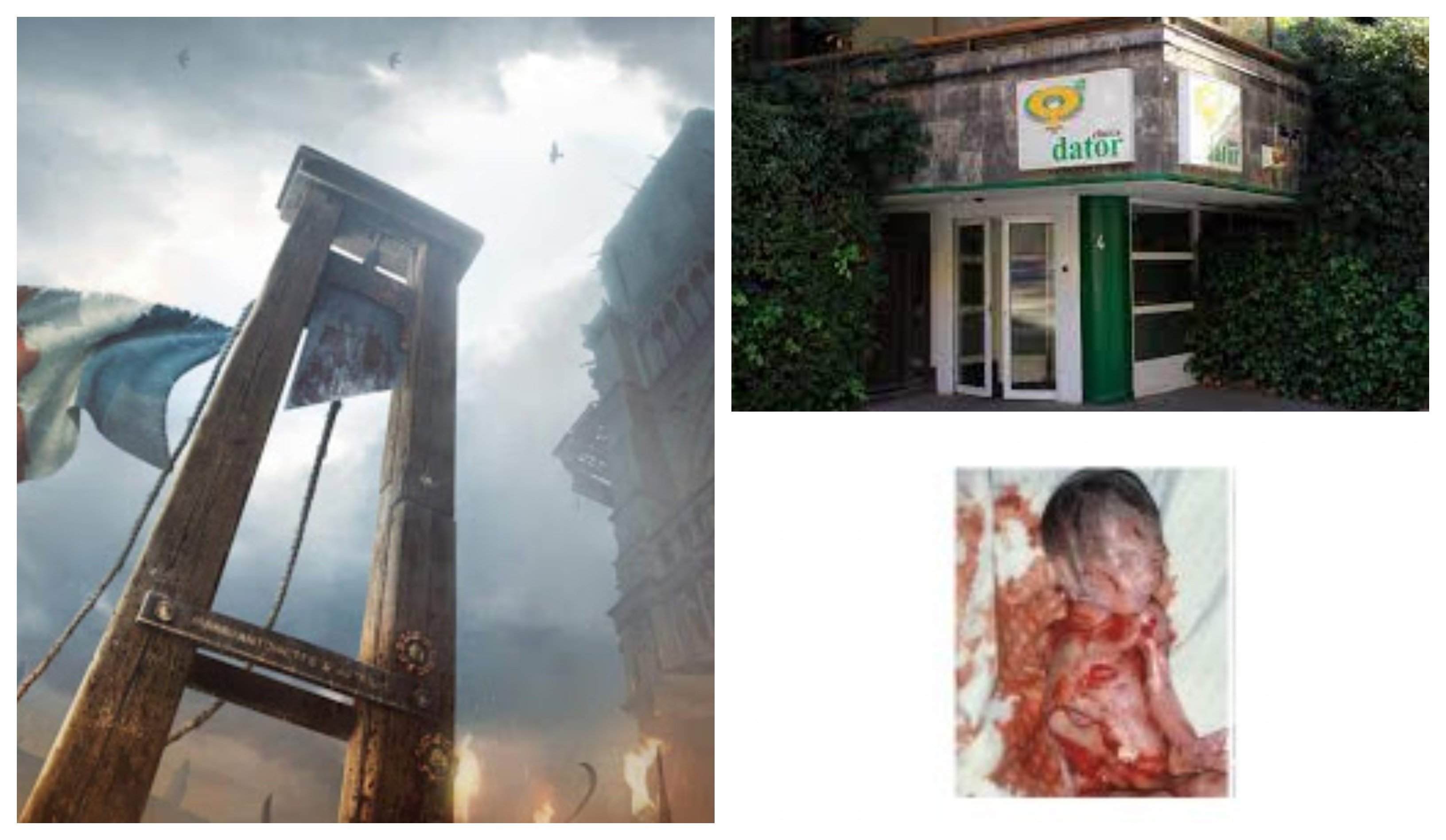 ¿Recuerdan el régimen de terror impuesto durante el jacobinismo en el transcurso de la Revolución Francesa? La supresión de la objeción de conciencia en el aborto consiste precisamente en esto: o colaboras activamente o serás guillotinado ¿Recuerdan el régimen de terror impuesto durante el jacobinismo en el transcurso de la Revolución Francesa? La supresión de la objeción de conciencia en el aborto consiste precisamente en esto: o colaboras activamente o serás guillotinado