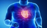 Aquellos pacientes que tengan un aumento de la grasa abdominal pueden presentar un incremento importante del riesgo de padecer enfermedades cardiovasculares