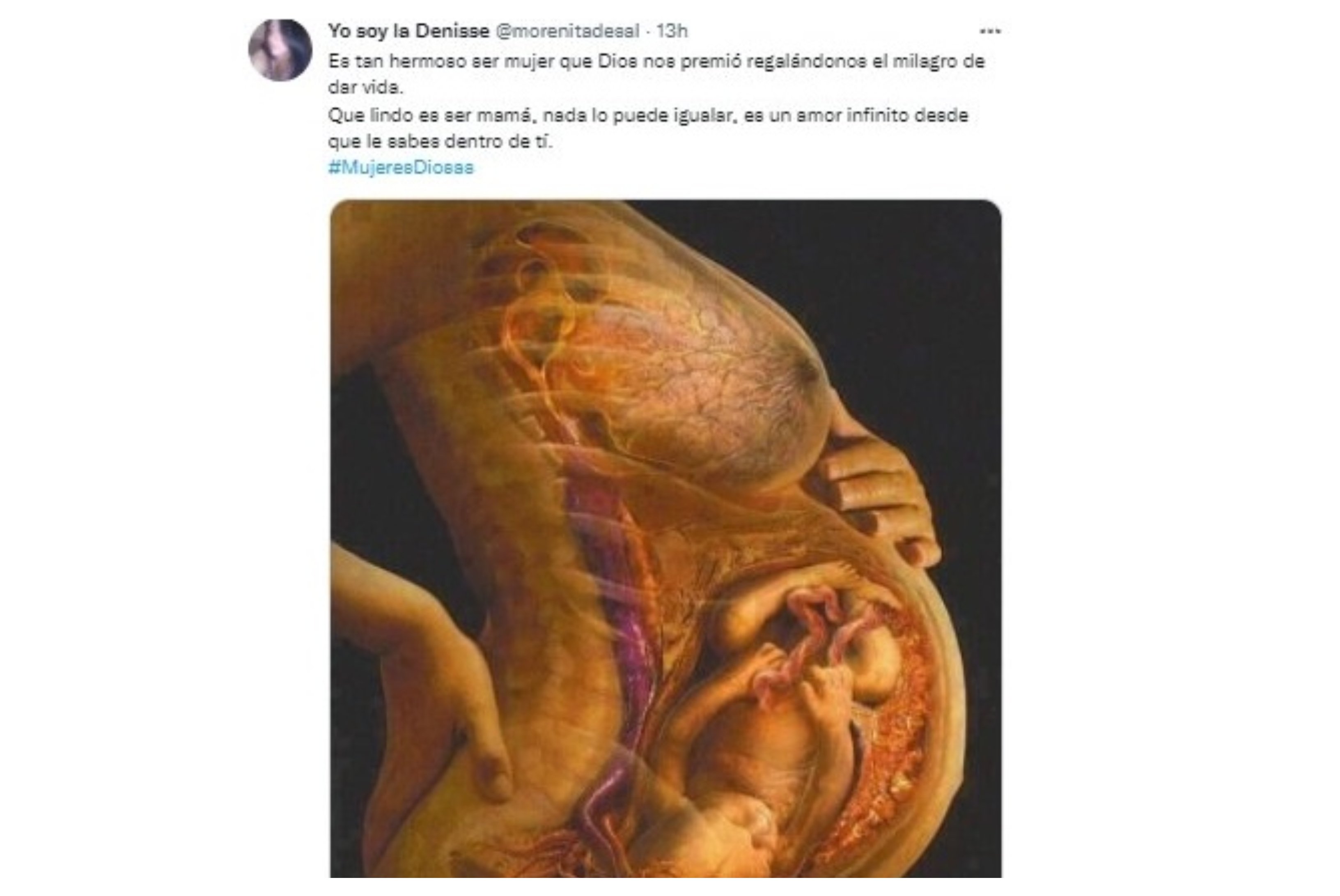 En todo embarazo lo que es bueno para la madre es bueno para el hijo y viceversa En todo embarazo lo que es bueno para la madre es bueno para el hijo y viceversa