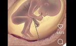 Ahora compartimos un vídeo donde se puede ver lo que significa el método farmacológico o aborto con pastillas, que según las clínicas abortistas "es más efectivo dentro de las 9 primeras semanas de embarazo"