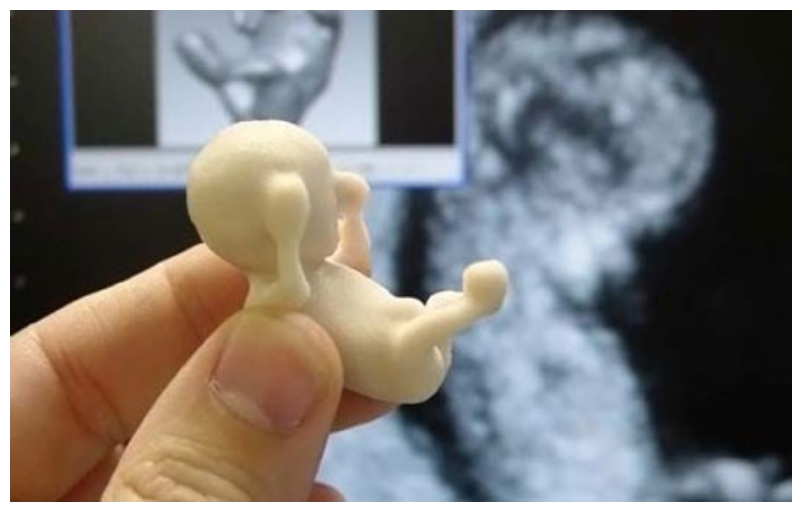 Малыш на 11 неделе. Эмбрион на 11 неделе беременности. Человеческий эмбрион на 12 неделе. Плод на 12 неделе беременности. Эмбрион на 11 неделе беременности фото.