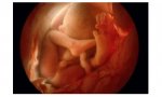 La Corte Suprema de Georgia avala la ley del “latido del corazón” que prohíbe los abortos a partir de las seis semanas de embarazo